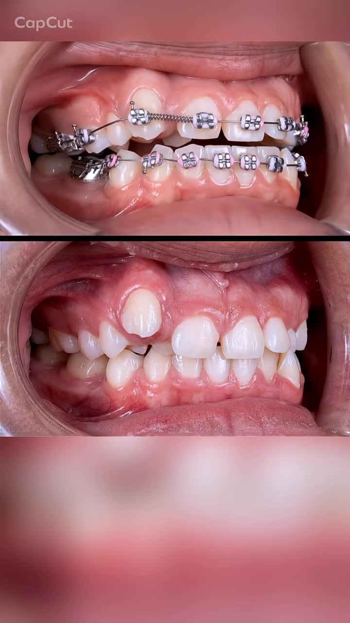 Hành trình gần 2 năm