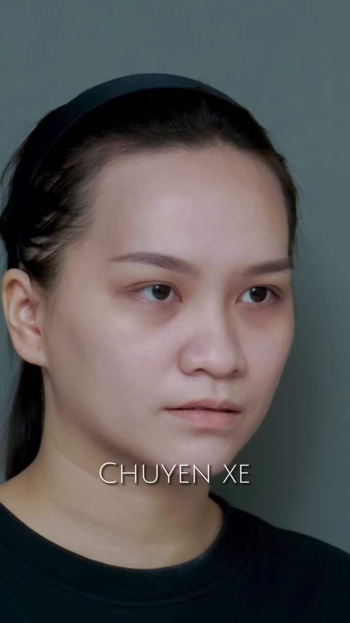 Hết mắt "gấu trúc", cải thiện cằm ngắn và khuôn mặt thiếu cân đối chỉ nhờ một phương pháp!