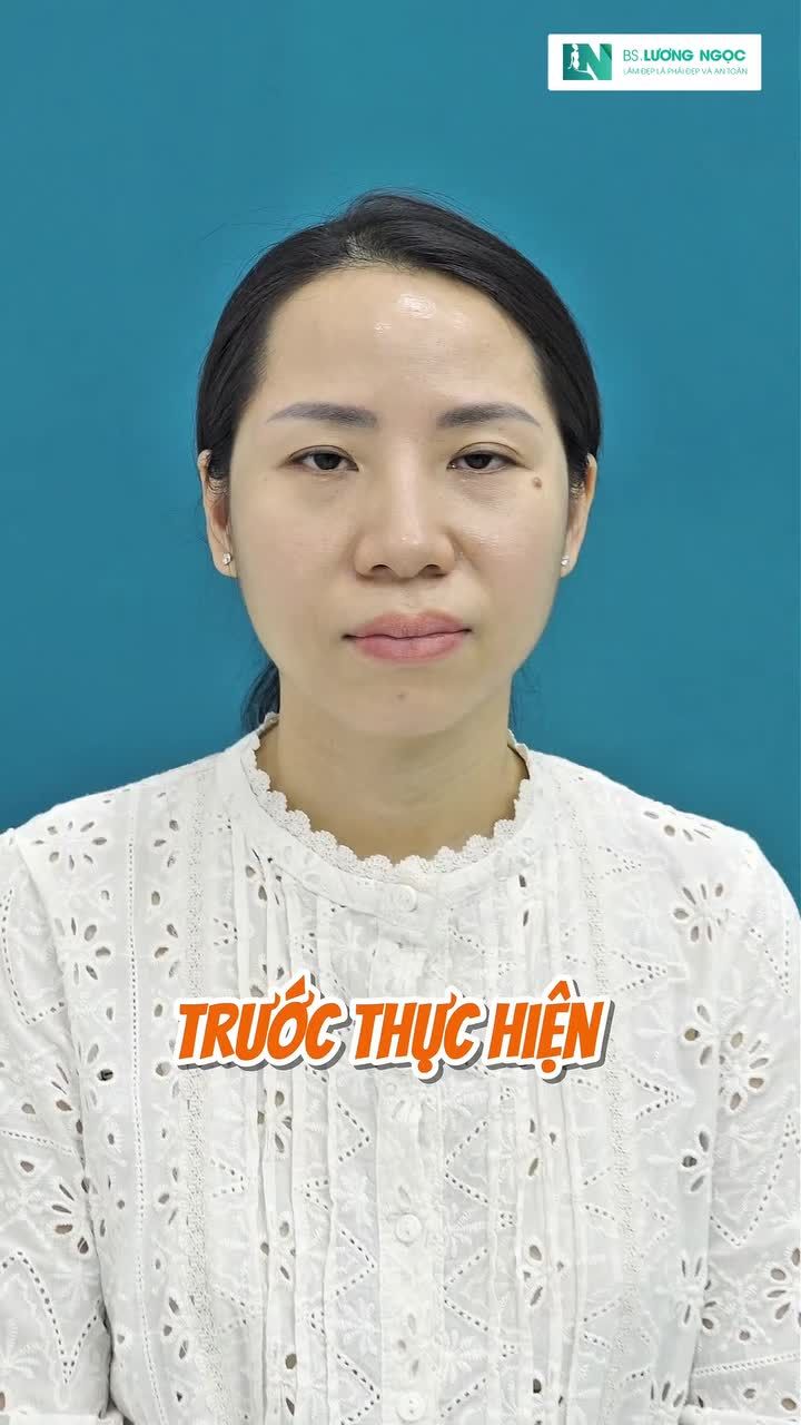 Ai muốn trẻ trung thì tới gặp Bác sĩ Lương Ngọc ngay nha