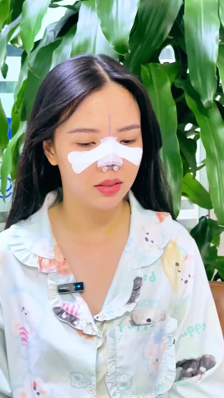 NỮ KHÁCH HÀNG QUẬN 2 SỞ HỮU DÁNG MŨI BỌC SỤN THANH THOÁT – NGHỈ HẲN 1 THÁNG ĐỂ "LỘT XÁC" ĐÓN DIỆN MẠO MỚI!