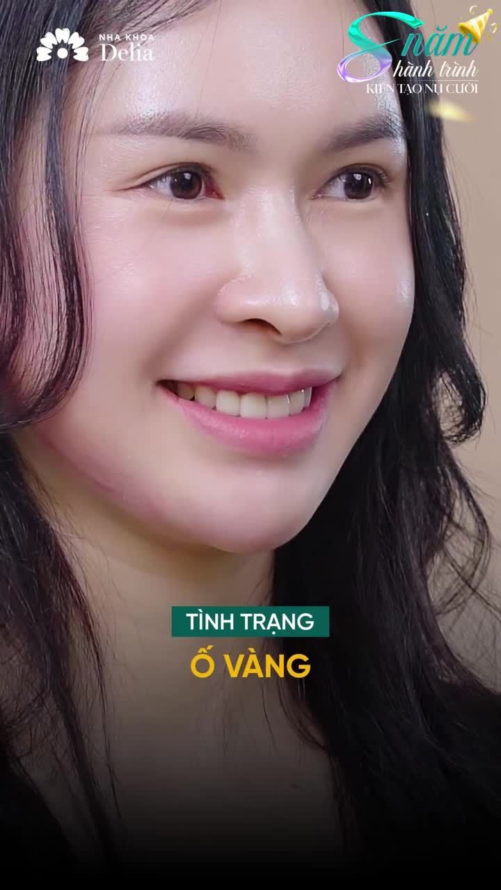 Khách hàng khẳng định: Làm răng sứ đẹp chọn Delia Hà Nội!? Kiểm chứng sự thật tại đây!