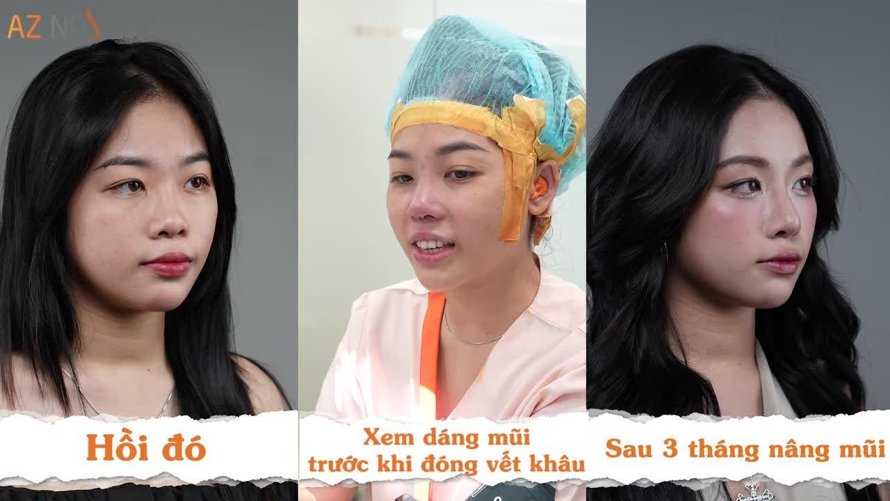 Mũi mới, vibe mới cho cô nàng GenZ
