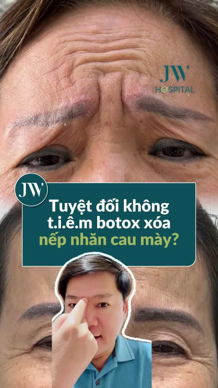 BÁC SĨ TÚ DUNG GIẢI MÃ VÌ SAO ĐỪNG VỘI TIÊM BOTOX XÓA NẾP NHĂN CAU MÀY