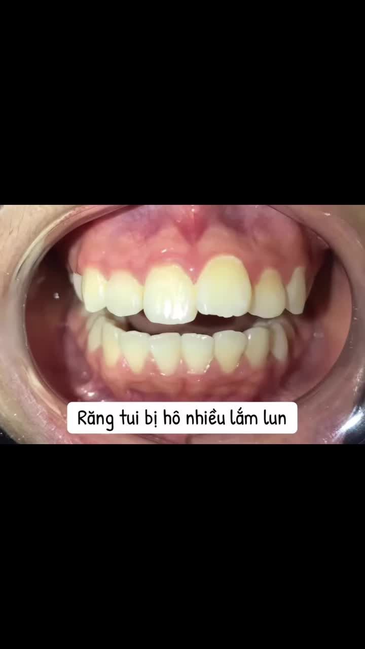 Thế nào là dậy thì thành công?