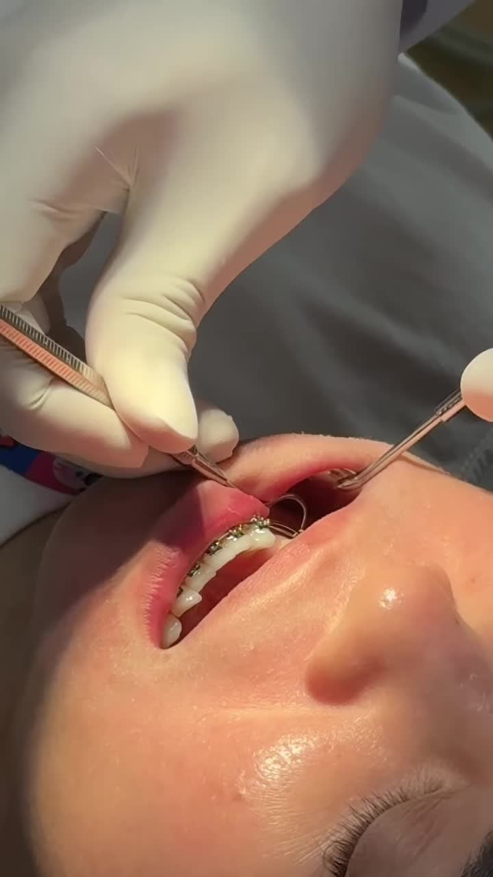 Một buổi tái khám niềng răng bắt đầu từ những nụ cười và kết thúc bằng một nụ cười tươi hơn