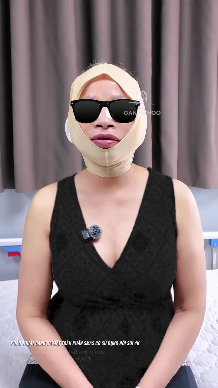 Cảm nhận của khách hàng sau phẫu thuật căng da mặt Smas có sử dụng nội soi 4K không đau nhẹ nhàng