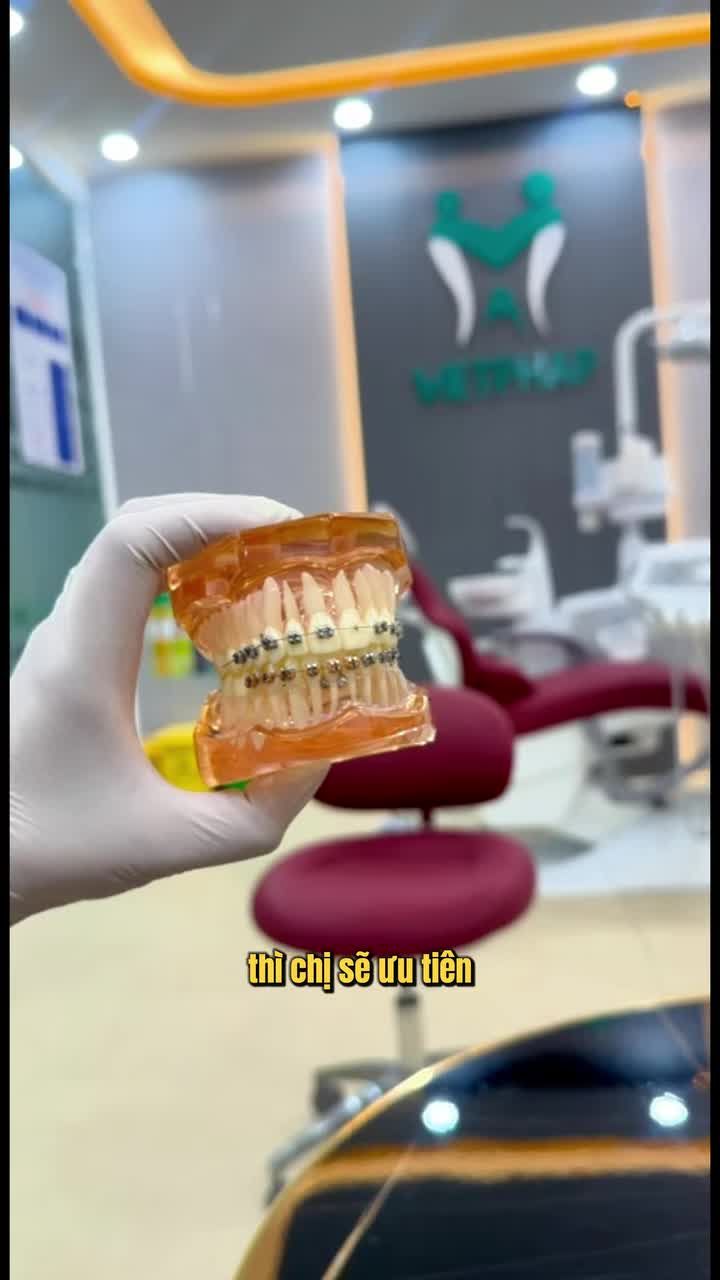 Các bạn học sinh, sinh viên nên niềng loại nào cho phù hợp?