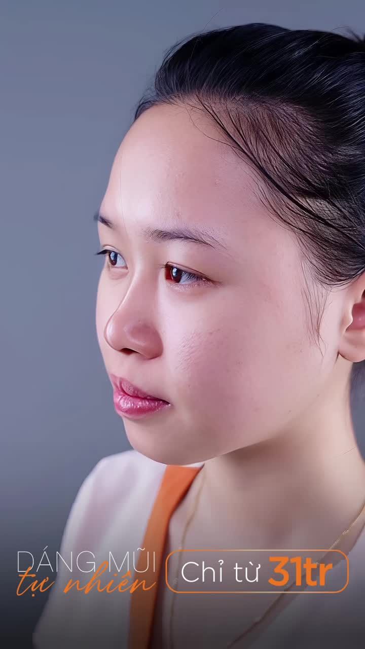 Sở hữu dáng mũi tự nhiên cùng AZNOSE - chỉ từ 31 triệu.