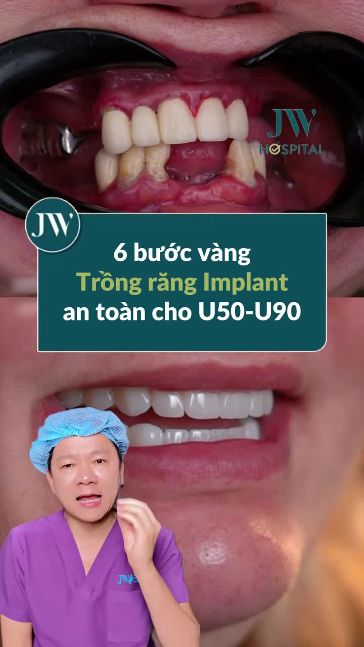 TIN VUI: CÔ CHÚ U50 - U90 KHÔI PHỤC RĂNG MẤT, ĂN NGON CƯỜI ĐẸP VỚI TRỒNG RĂNG IMPLANT CHUẨN Y KHOA TẠI JW