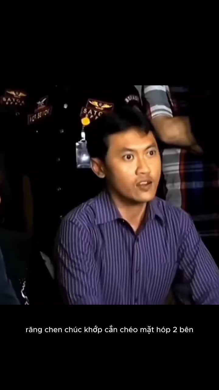 Hé lô các con vợ Răng chen chúc chưa chắc do răng to đâu — nhiều khi do hàm trên quá hẹp.