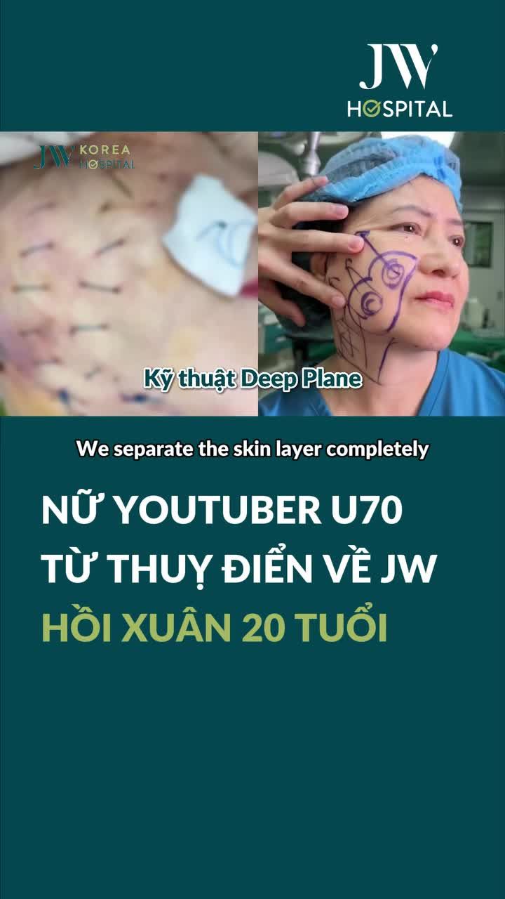 CĂNG DA MẶT SMAS PRO CỦA BÁC SĨ TÚ DUNG ĐỈNH CỠ NÀO? YOUTUBER U70 THUỴ ĐIỂN SỐC VÌ TRẺ LẠI 20 TUỔI
