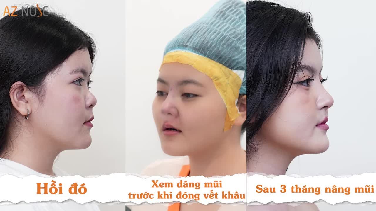 Gương mặt và thần thái của em gái TikToker Quyên Emie khác biệt rất lớn chỉ sau 3tháng