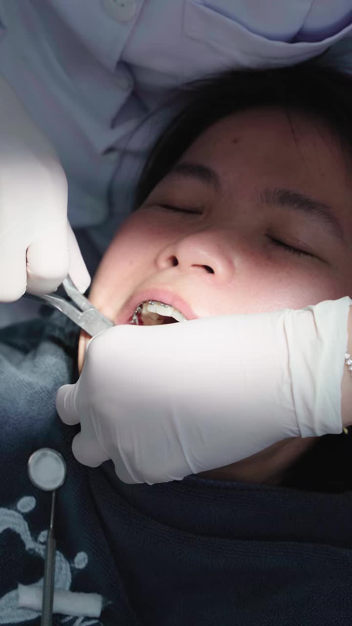 U50 QUYẾT TÂM THEO ĐUỔI HÀNH TRÌNH NIỀNG RĂNG - NHẬN KẾT QUẢ NHƯ Ý
