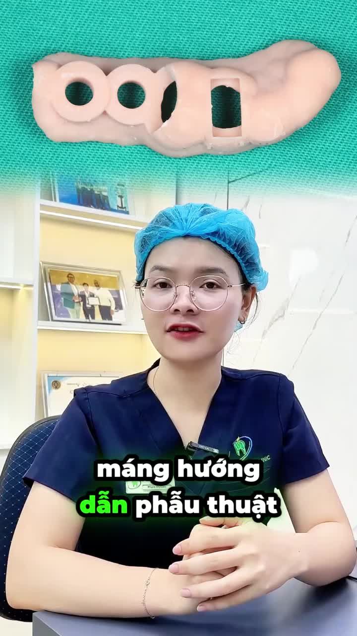 TRƯỚC KHI TRỒNG IMPLANT, CÓ MỘT CÂU BẠN NHẤT ĐỊNH NÊN HỎI BÁC SĨ!