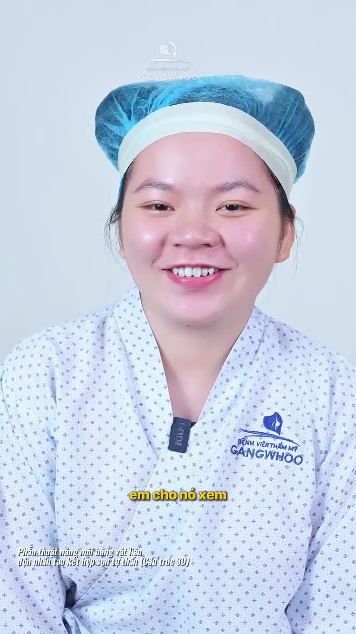 Quyết tâm nâng mũi để tự tin đồng hành cùng bạn thân trong ngày trọng đại