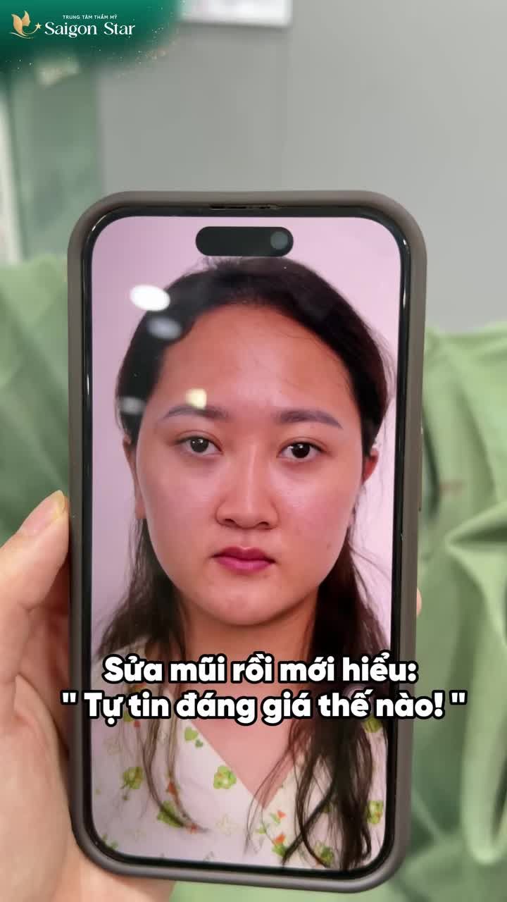 THAY ĐỔI DIỆN MẠO THÊM PHẦN TỰ TIN CHỈ SAU 60 PHÚT ĐỂ ĐƯỢCBÁC SĨ HOẠT THIẾT KẾ DÁNG MŨI ĐỘC BẢN