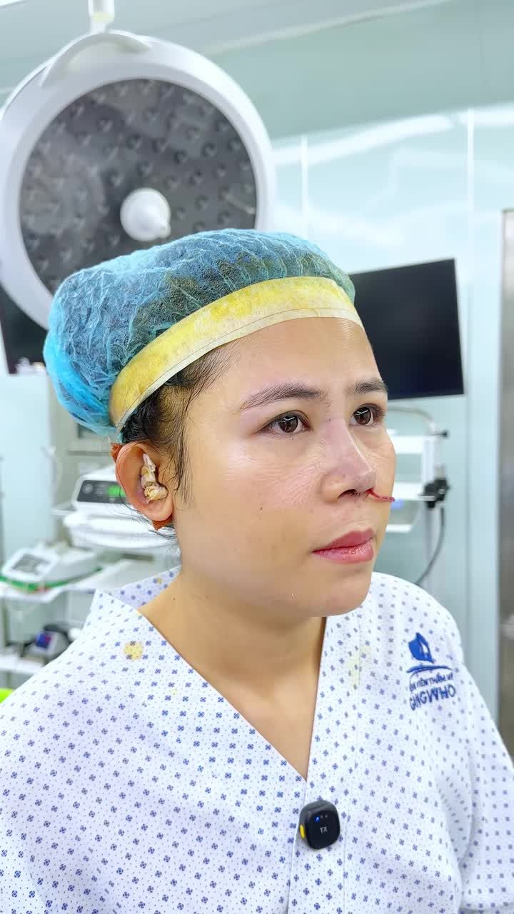 KHÁCH HÀNG "CHỐT ĐƠN" TRONG 1 NGÀY – NÂNG MŨI CẤU TRÚC ĐỔI VẬN, TẠM BIỆT MŨI HỈNH LẠI TIỀN!