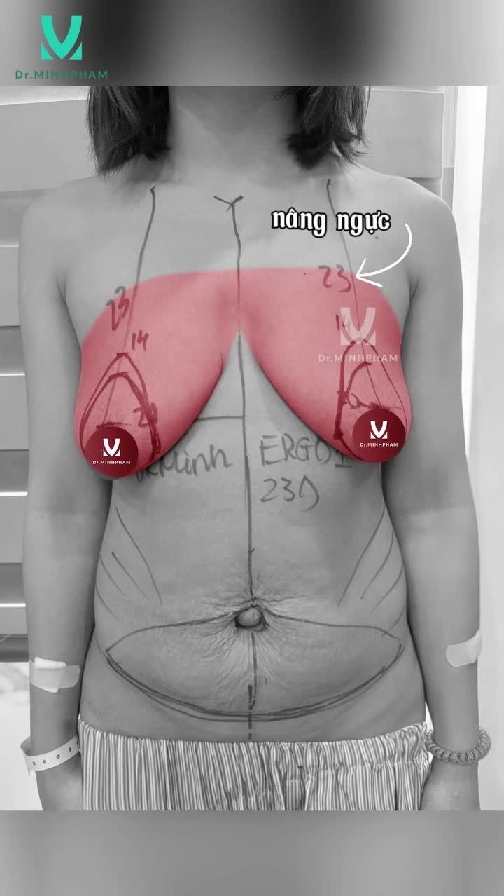 HÚT MỠ – CƠ THỂ GỌN GÀNG, DIỆN MẠO THĂNG HẠNG
