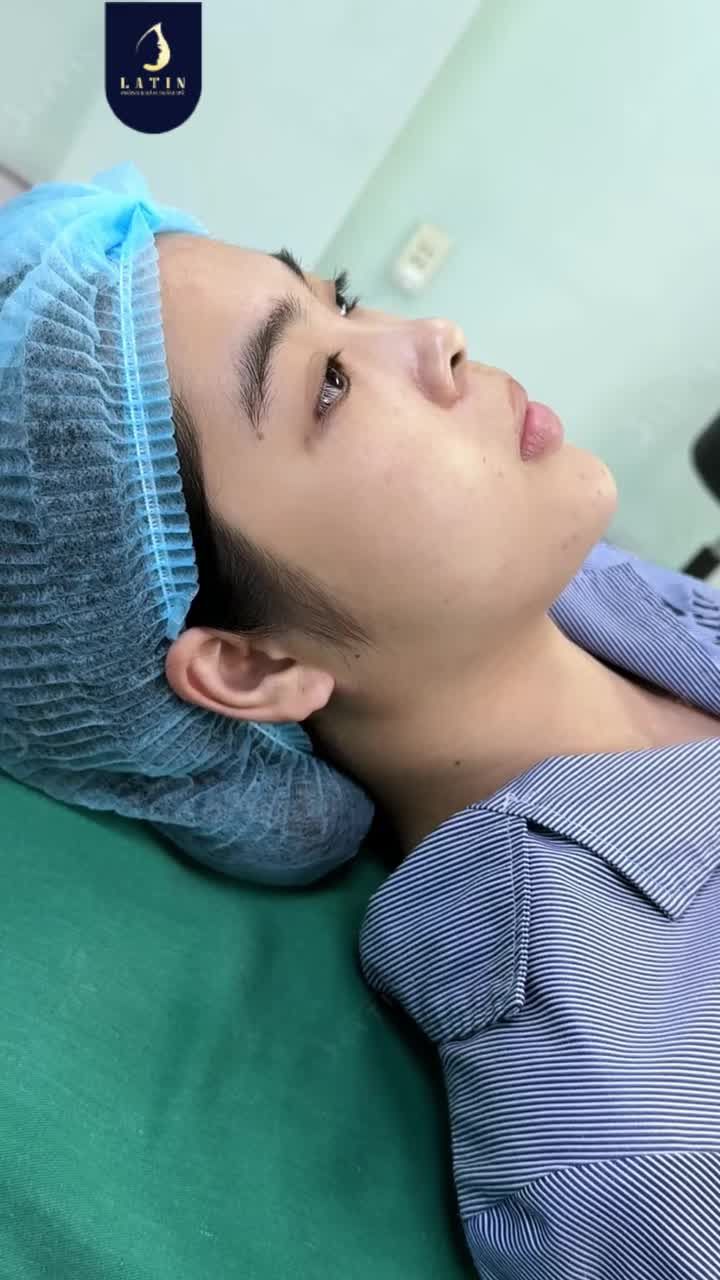 “BẢO VẬT” SURGIFORM – BỀN TỪ BÊN TRONG, SANG TỪ DÁNG MŨI