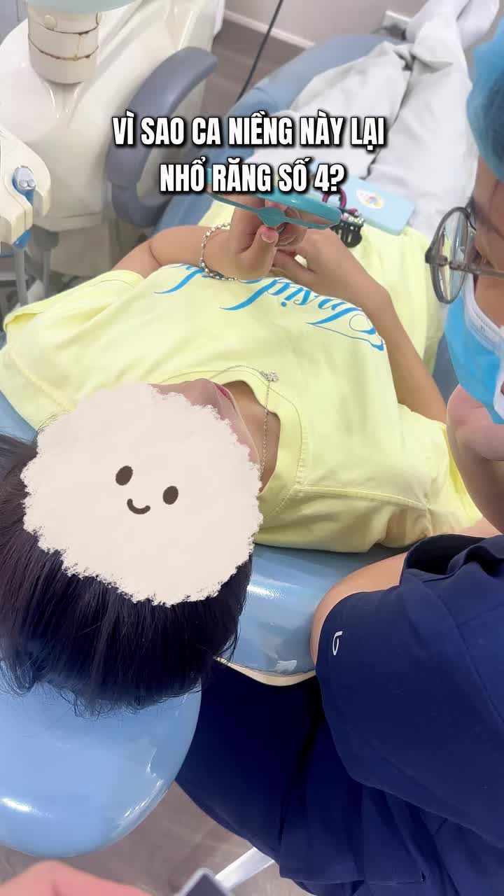 Lý do cần nhổ r4 mà nhiều bạn thắc mắc
