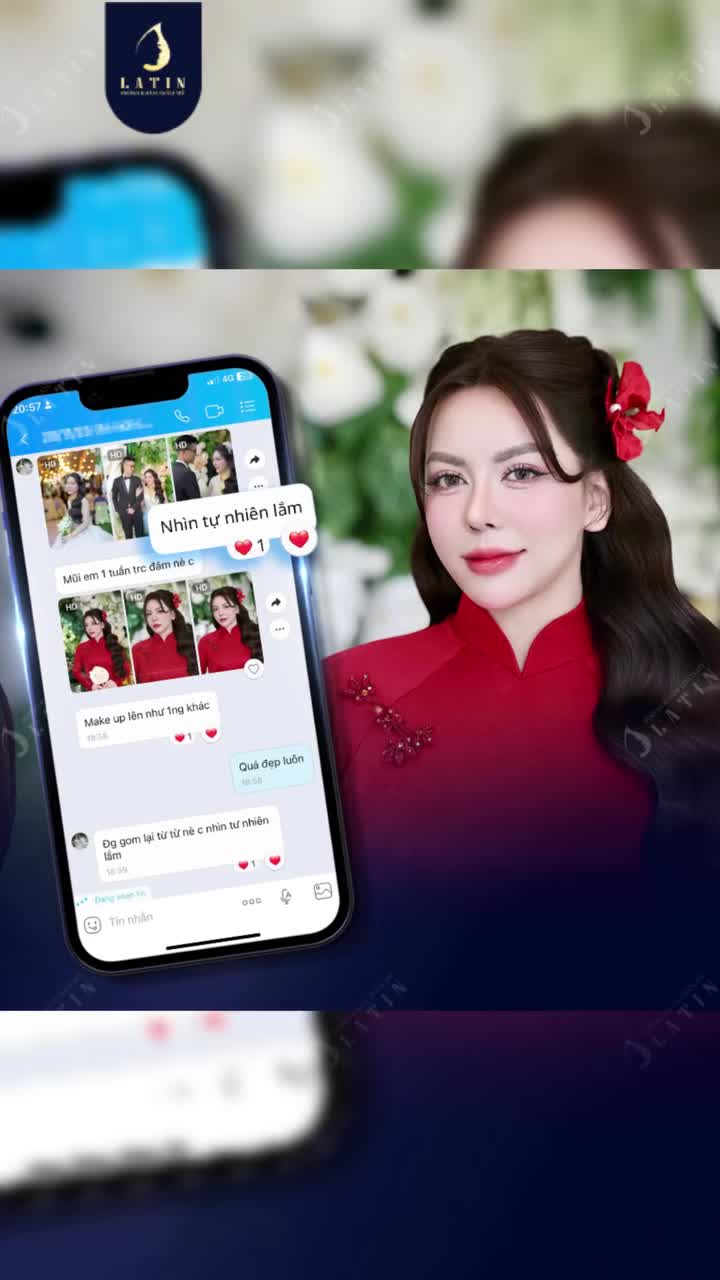 Sửa mũi đổi vận
