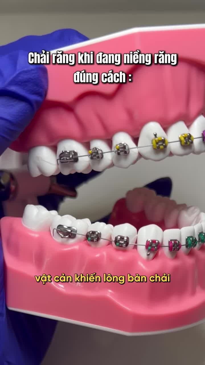 Cách chải răng đúng cách