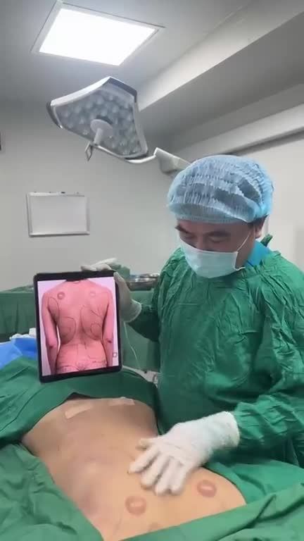 Đặc sắc với “Hút mỡ LƯNG ko SẸO” tại Dr Vương