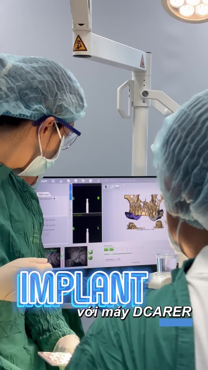 Hé lô các con vợ Cắm implant mà không có định vị thì khác gì chạy xe không mở Google Maps.