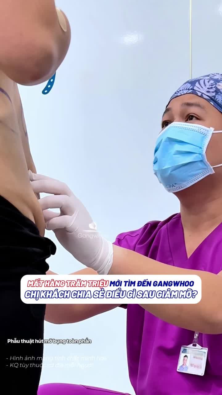 Mất hàng trăm triệu mới tìm đến Gangwhoo, chị khách chia sẻ điều gì sau giảm mỡ bụng bằng công nghệ Lipo Ultrasound ?