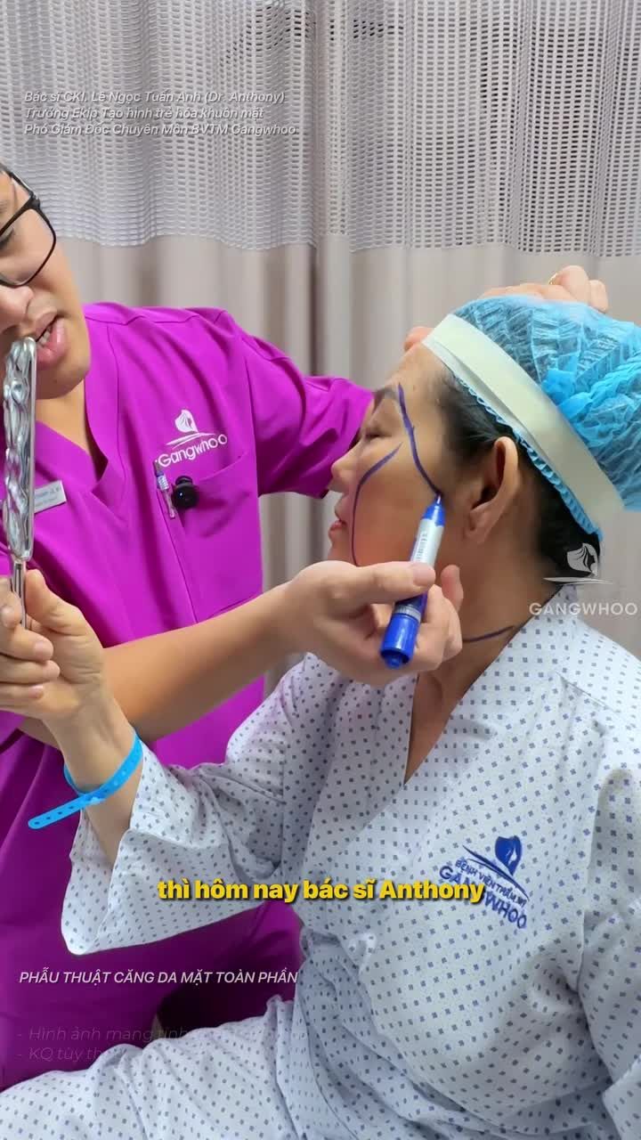 Tiêu chí nào tạo nên một ca căng da mặt thành công tại Bệnh viện thẩm mỹ Gangwhoo