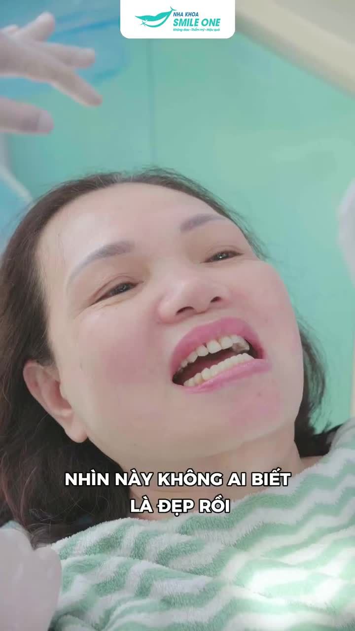 "U60 rồi còn làm răng sứ làm gì?"