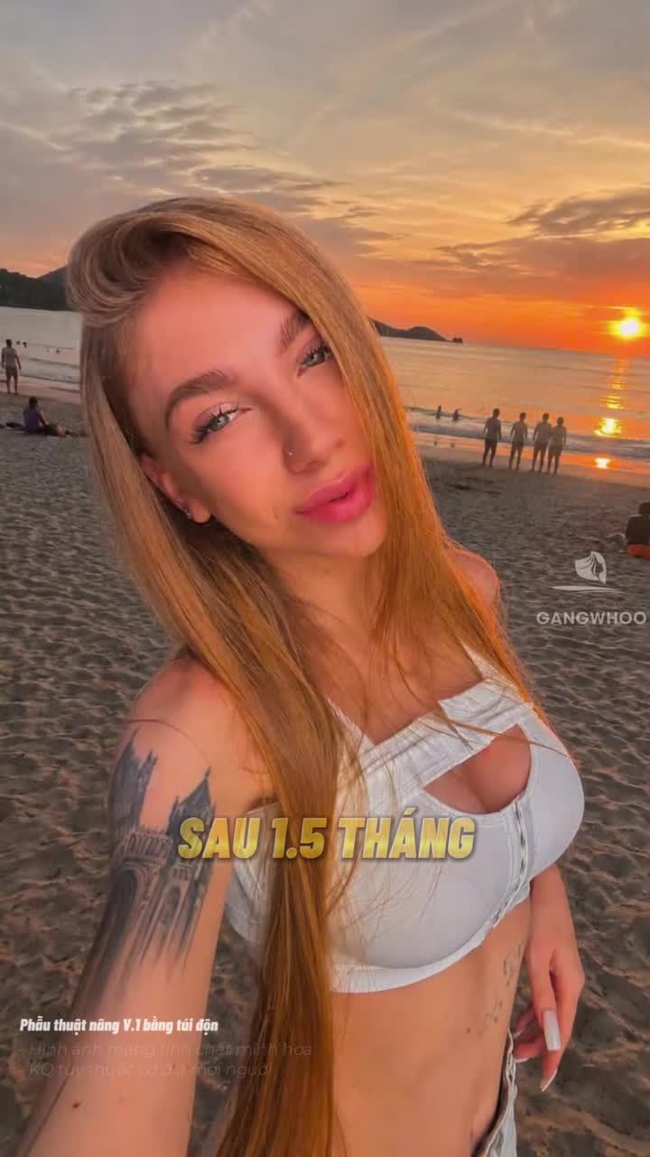 Biến hình cực cháy từ cô nàng người Nga sau hành trình tân trang dáng vòng 1 tại Gangwhoo