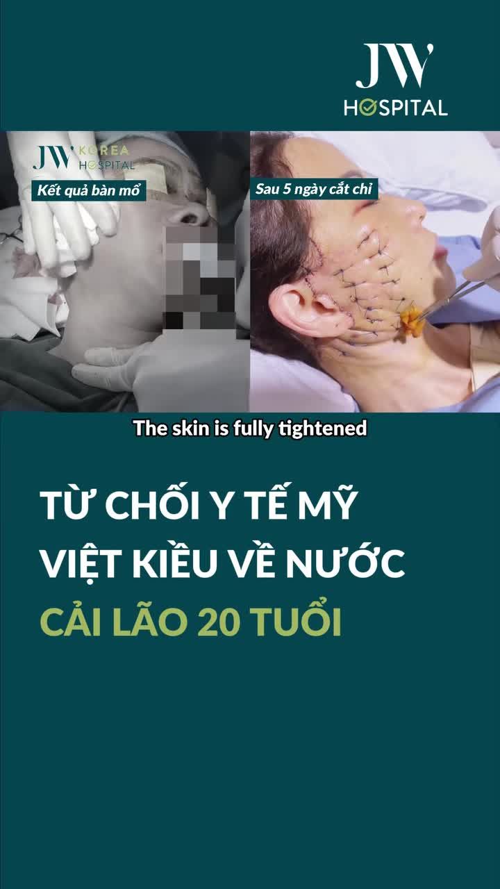 TỪ CHỐI Y TẾ MỸ VÌ BÁC SĨ TÚ DUNG CĂNG DA MẶT, K.H.Â.U CƠ QUÁ ĐỈNH GIÚP VIỆT KIỀU U70 TRẺ 20 TUỔI