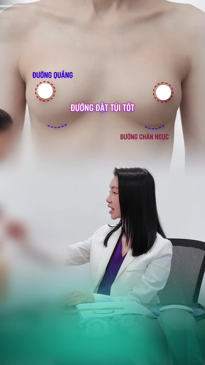 MỖI CA NÂNG NGỰC ĐỀU CÓ MỘT LỜI GIẢI RIÊNG