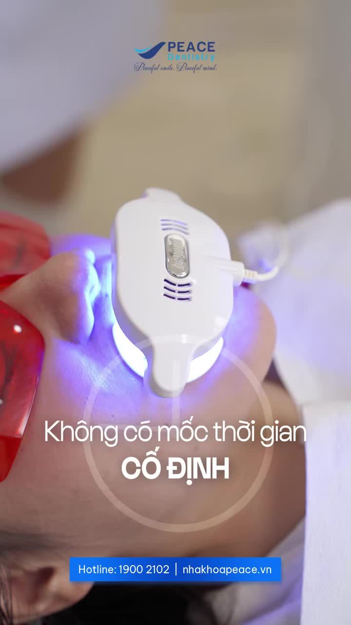 Tẩy trắng răng bao lâu thì cần làm lại?