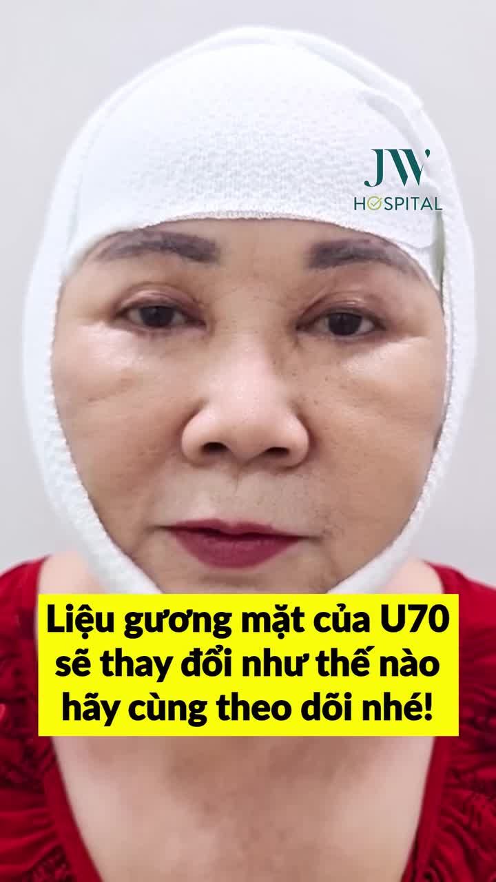 BÀ NGOẠI 72 TUỔI ĐƯỢC GIA ĐÌNH TẶNG NỬA TỎI ĐẾN JW CĂNG DA MẶT TRẺ 20 TUỔI