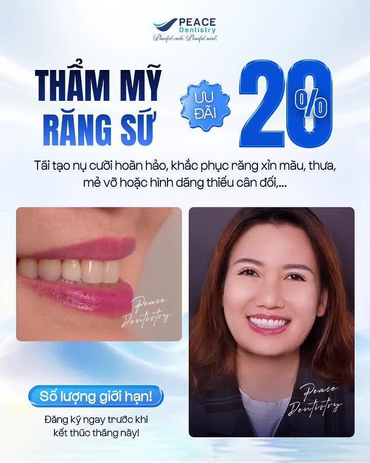 Sở Hữu Nụ Cười "Triệu Đô" Với Ưu Đãi Độc Quyền Tháng Này