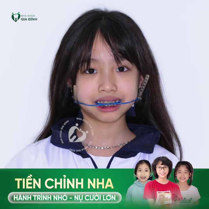 TIỀN CHỈNH NHA: HÀNH TRÌNH NHỎ - NỤ CƯỜI LỚN