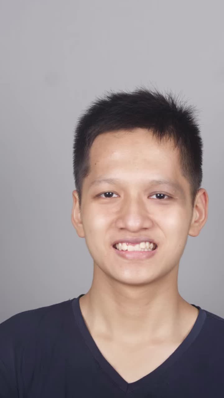 Tình trạng: Răng hai hàm khấp khểnh, cung răng hẹp, răng cửa cắn sâu, khớp cắn hạng II và đường giữa hàm dưới lệch.