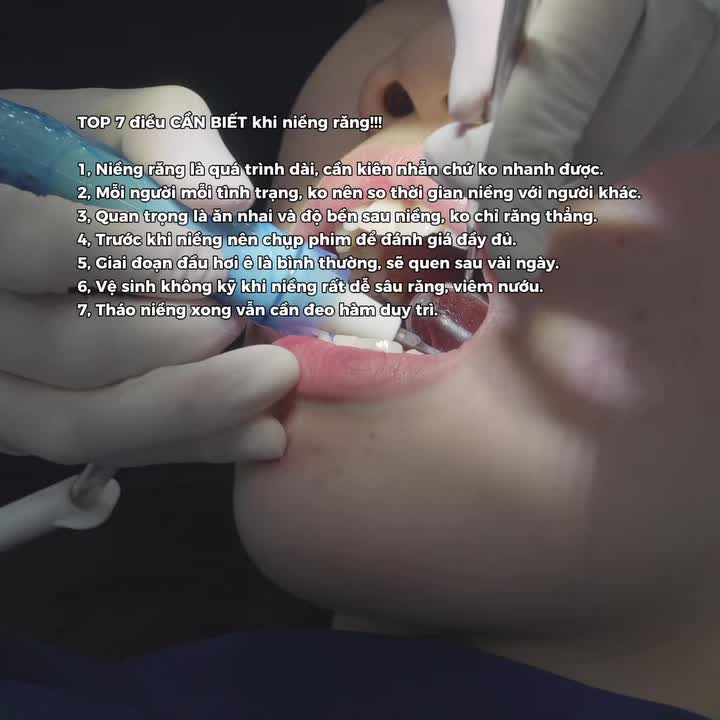 Chuẩn bị niềng răng? Lưu ngay 7 điều cần biết trước khi niềng răng để chuẩn bị tốt hơn cho hành trình thay đổi nụ cười của mình.