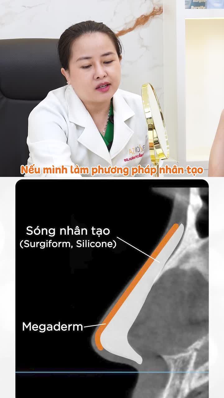 Tình trạng mũi như TikToker Đào nên chọn phương pháp nào để dáng mũi thon gọn, cân đối hơn?
