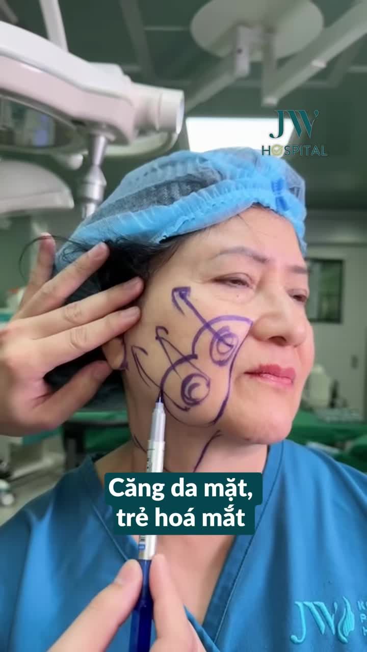 SỬNG SỐT: CĂNG DA MẶT SMAS PRO, TRẺ HOÁ MẮT TẠI JW KHIẾN NỮ YOUTUBER U70 THUỴ ĐIỂN TRẺ 20 TUỔI