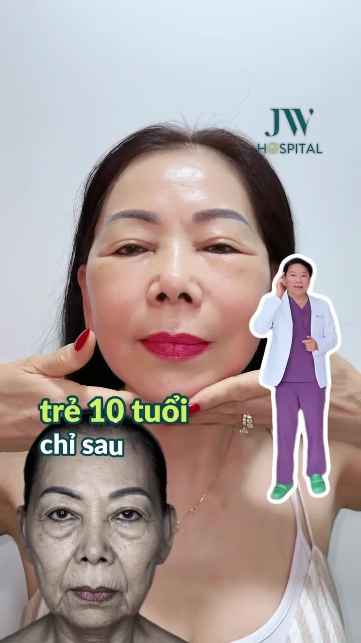 VIỆT KIỀU MỸ 40-90 TUỔI SỢ GIÀ, RÃNH CƯỜI SÂU? BÁC SĨ TÚ DUNG TẶNG GIẢI PHÁP TRẺ 10 TUỔI SAU 1 TUẦN