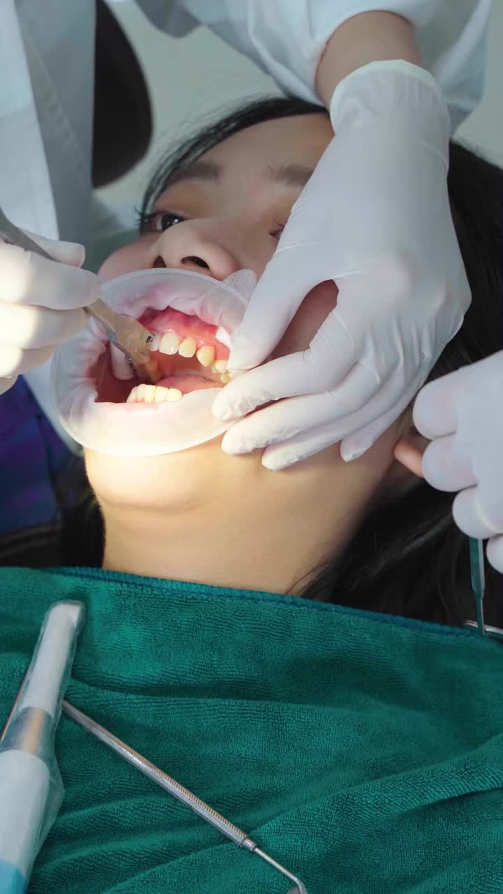 NIỀNG RĂNG LẦN 2 - QUYẾT TÂM TÌM LẠI NỤ CƯỜI ĐÚNG NHƯ MONG MUỐN