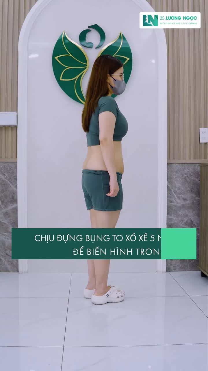 Sau 5 năm sống chung với mo~ bụng, liệu lần thay đổi này có xứng đáng như mong đợi?