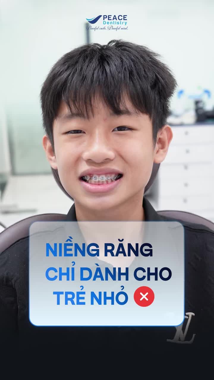 NIỀNG RĂNG ĐÚNG THỜI ĐIỂM – TẶNG BẢN THÂN DIỆN MẠO MỚI TỰ TIN