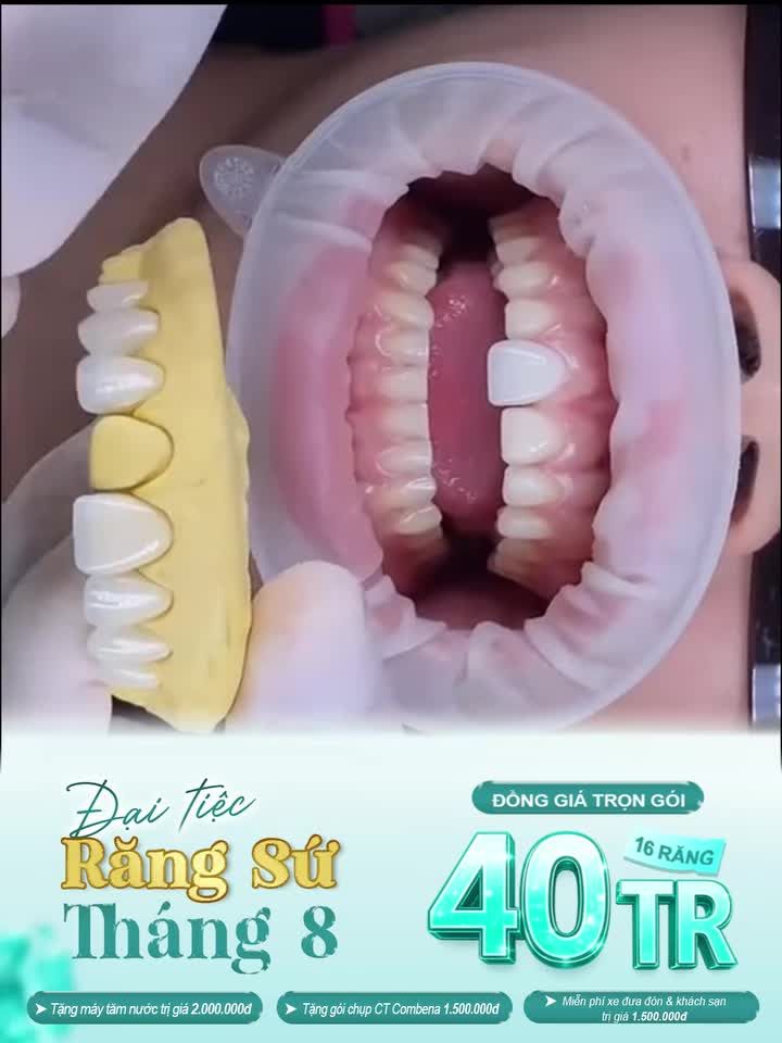 CƠ HỘI CÓ HẠN: DÀNH CHO BẠN