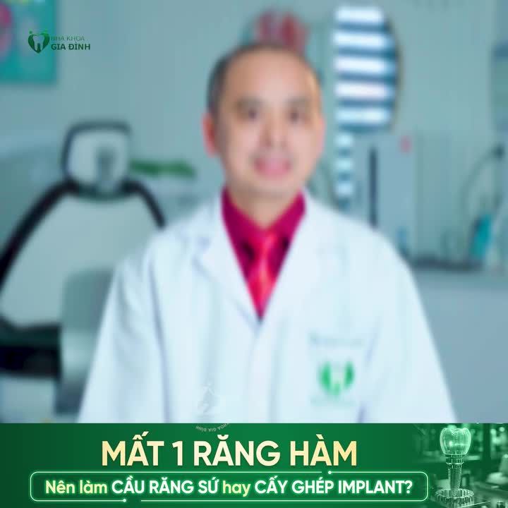 MẤT 1 RĂNG HÀM: NÊN LÀM CẦU RĂNG SỨ HAY CẤY GHÉP IMPLANT?