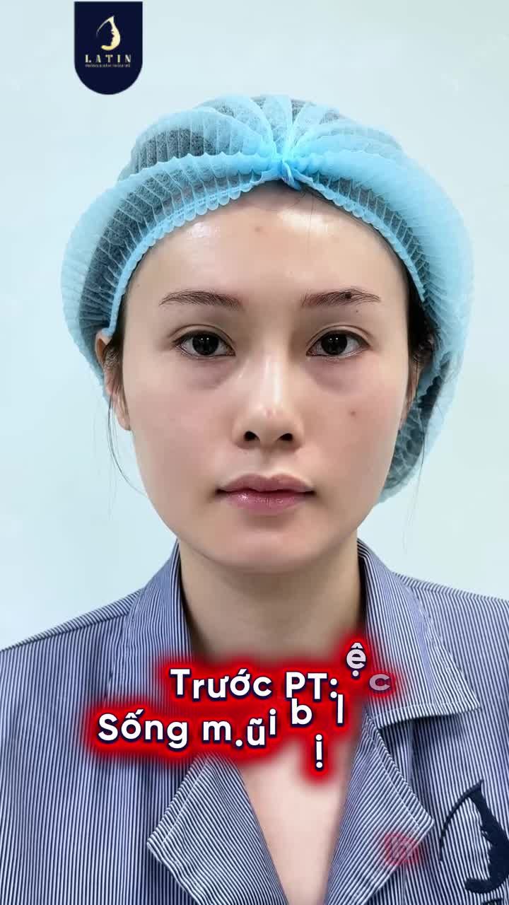70% ĐỘ XINH ĐƯỢC QUYẾT ĐỊNH BỞI CHIẾC MŨI?
