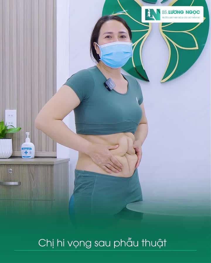 Đã từng hút mỡ rồi... liệu có thể cải thiện lần nữa không?